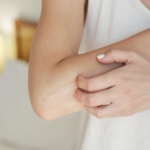 Understanding Atopic Dermatitis: Causes, Symptoms, and Relief